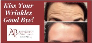 Read more about the article Rejuvenate Now with Botox/Dysport: What You Need to Know