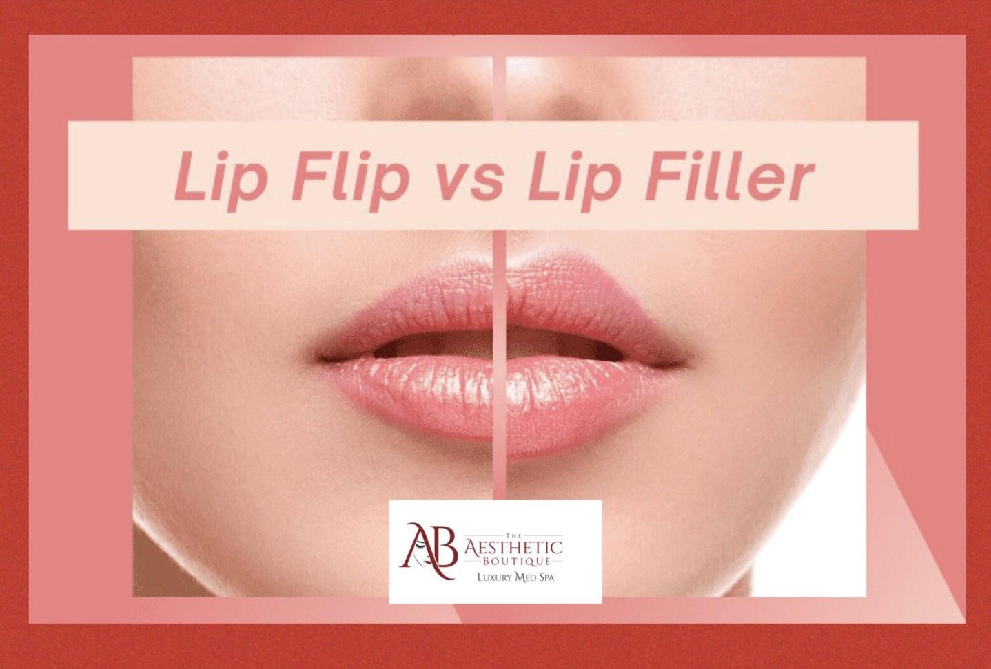 You are currently viewing Enhancing Lips with Botox and Fillers for the Perfect Valentine’s Kiss