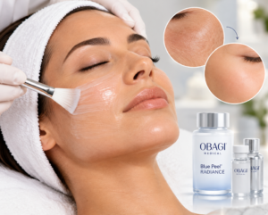 Obagi Facial Peels in Lafayette La
